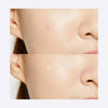 COSRX Acne Treatment Acne Pimple Master Patch - Original Care