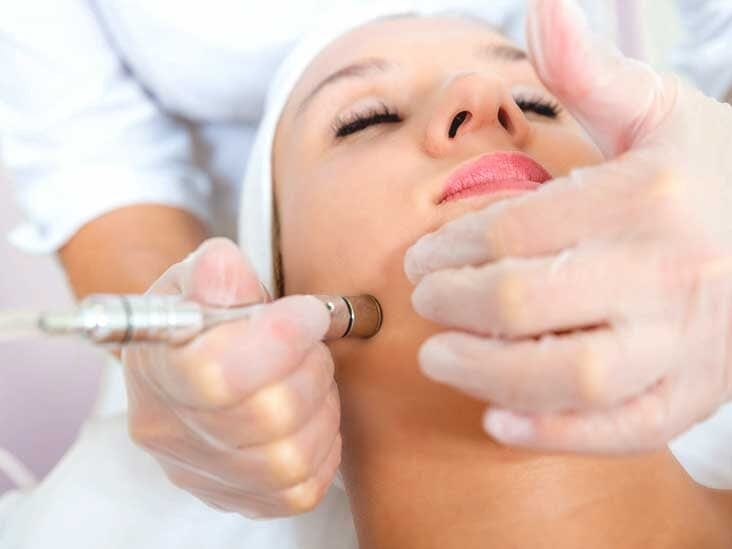 Eiluj Spa 30 minutes Facial Treatment - Microdermabrasion